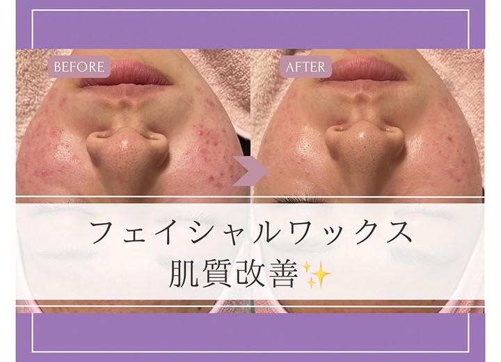 伊賀唯一のフェイシャルワックス専門店